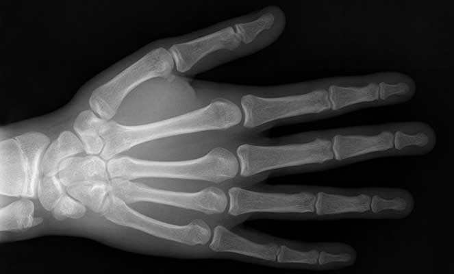 Raio-X de uma mão